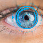 La chirurgie laser des yeux : retrouvez votre liberté visuelle
