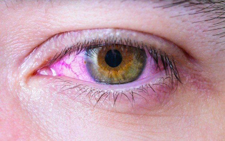 Les yeux rouges